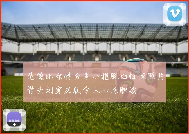 范德比尔特分享小指脱臼惊悚照片骨头刺穿皮肤令人心惊胆战